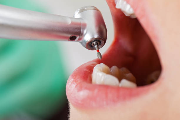 Best Knocked-Out Tooth Emergency  in Mankato, MN